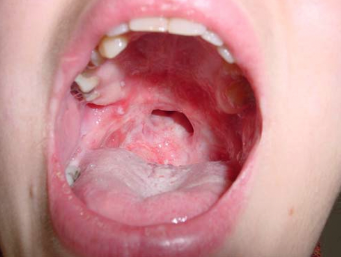 f:id:CTD_GIM:20220103212337p:image