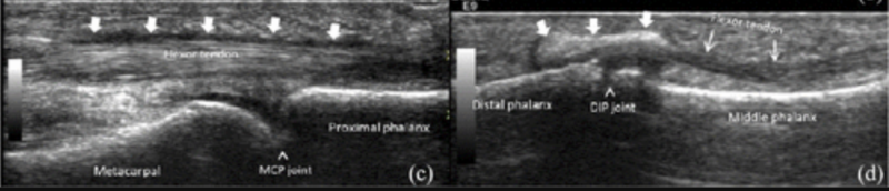 f:id:CTD_GIM:20220109202833p:image