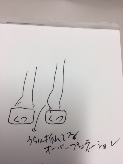 f:id:Choei:20161003115107j:plain