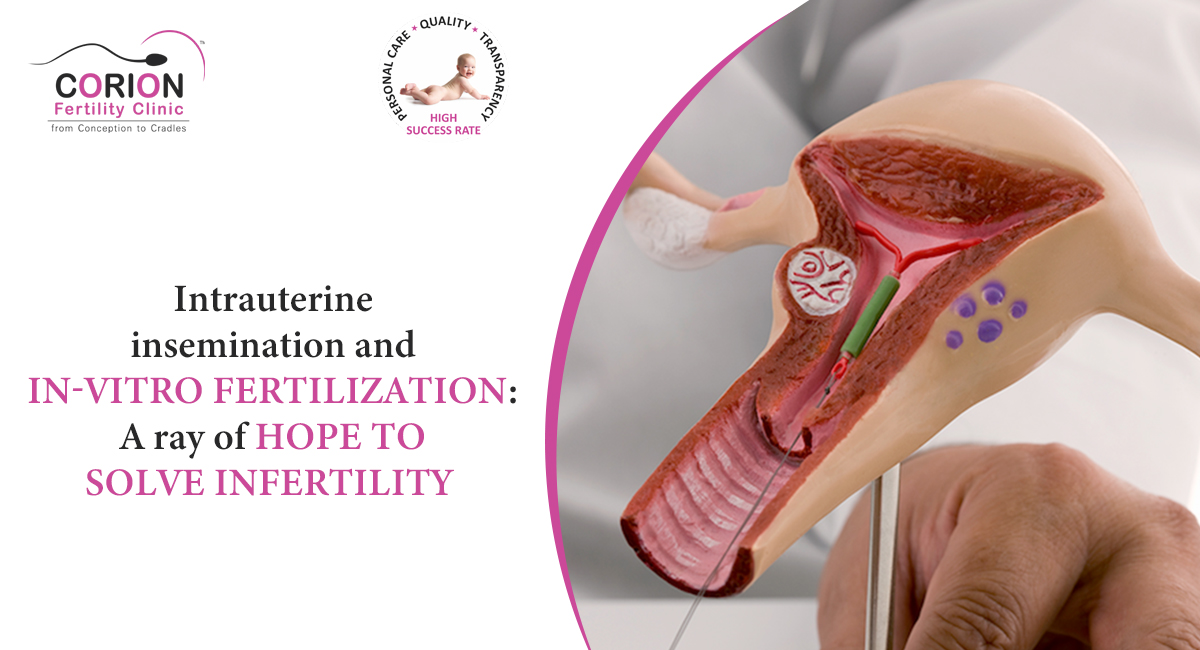 f:id:Confertilityclinic:20190827172004j:plain