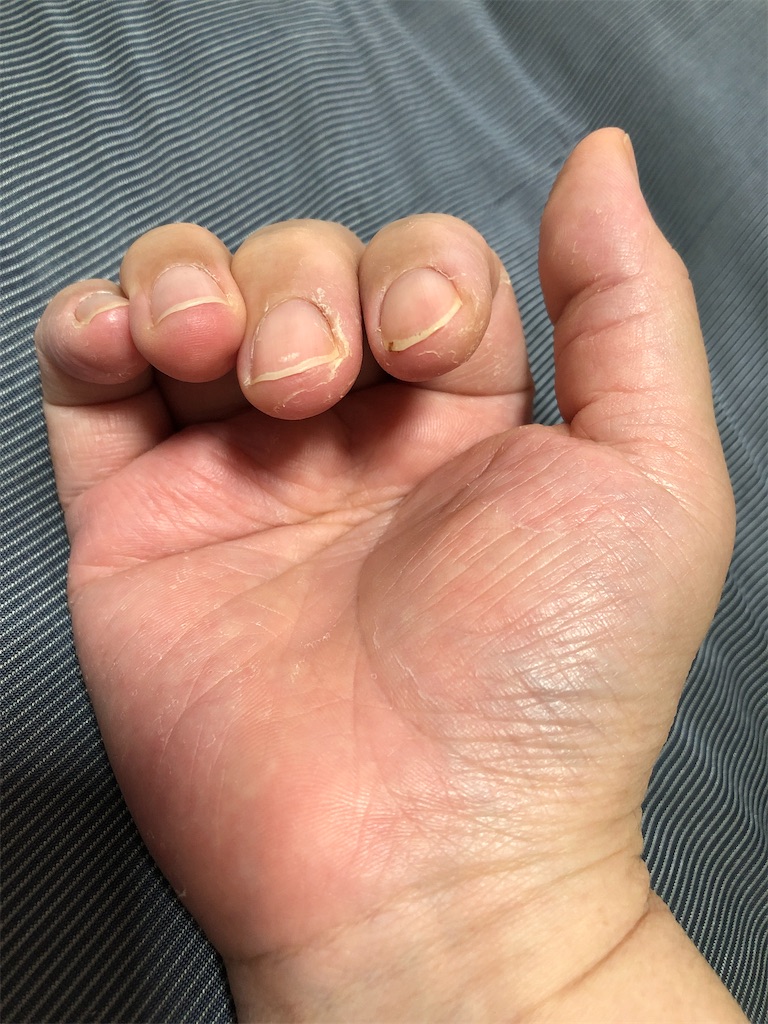 f:id:DORAAKITTY:20210521165956j:plain