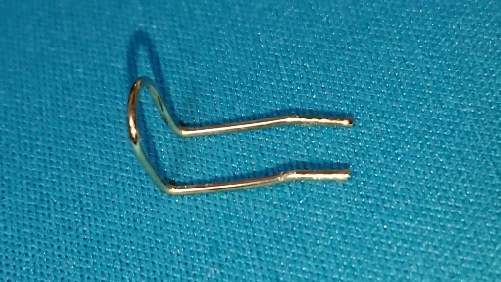 f:id:DoseiDonut:20180508004112j:plain f:id:DoseiDonut:20180508004112j:plain