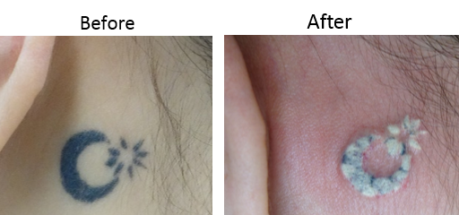 f:id:DrLUCE:20150529214651p:plain