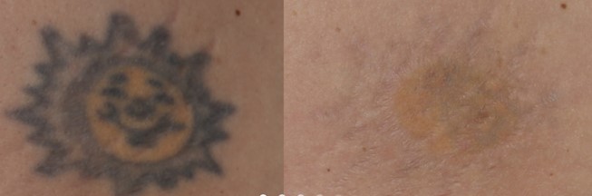 f:id:DrLUCE:20160129134120j:plain f:id:DrLUCE:20160129134120j:plain