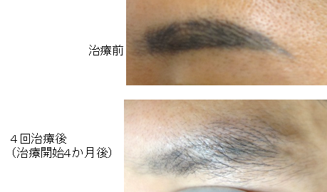 f:id:DrLUCE:20160227213352p:plain f:id:DrLUCE:20160227213352p:plain