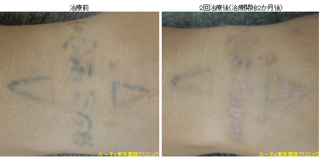 f:id:DrLUCE:20160808101518p:plain