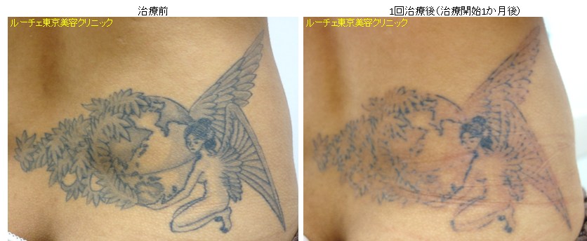 f:id:DrLUCE:20160911112042p:plain f:id:DrLUCE:20160911112042p:plain