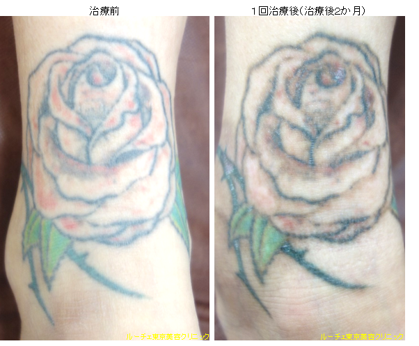 f:id:DrLUCE:20160918151714p:plain