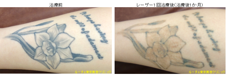 f:id:DrLUCE:20160923164729p:plain f:id:DrLUCE:20160923164729p:plain