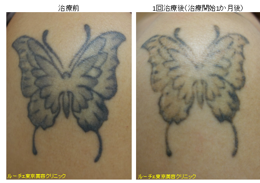f:id:DrLUCE:20161123204109p:plain f:id:DrLUCE:20161123204109p:plain