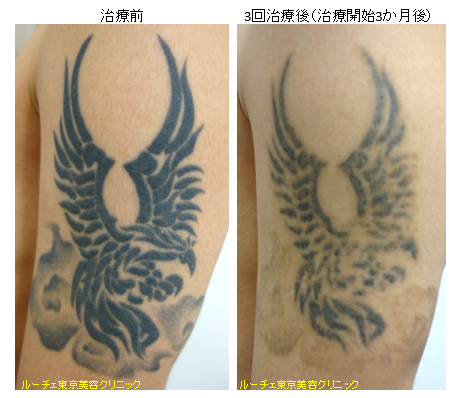 f:id:DrLUCE:20161222140521p:plain f:id:DrLUCE:20161222140521p:plain