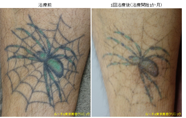 f:id:DrLUCE:20170112112453p:plain f:id:DrLUCE:20170112112453p:plain