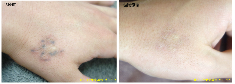 f:id:DrLUCE:20170311100502p:plain f:id:DrLUCE:20170311100502p:plain