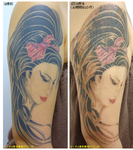 f:id:DrLUCE:20170520151832p:plain f:id:DrLUCE:20170520151832p:plain