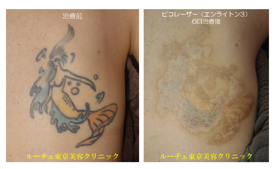 f:id:DrLUCE:20171213193628p:plain f:id:DrLUCE:20171213193628p:plain