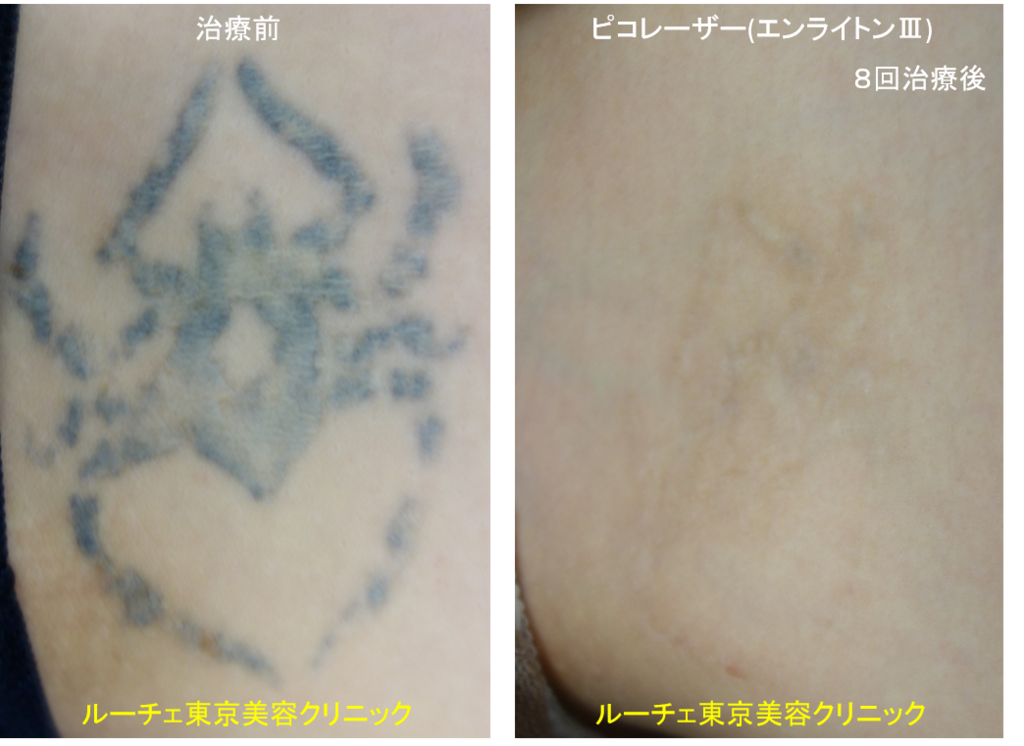 f:id:DrLUCE:20180620180226p:plain f:id:DrLUCE:20180620180226p:plain