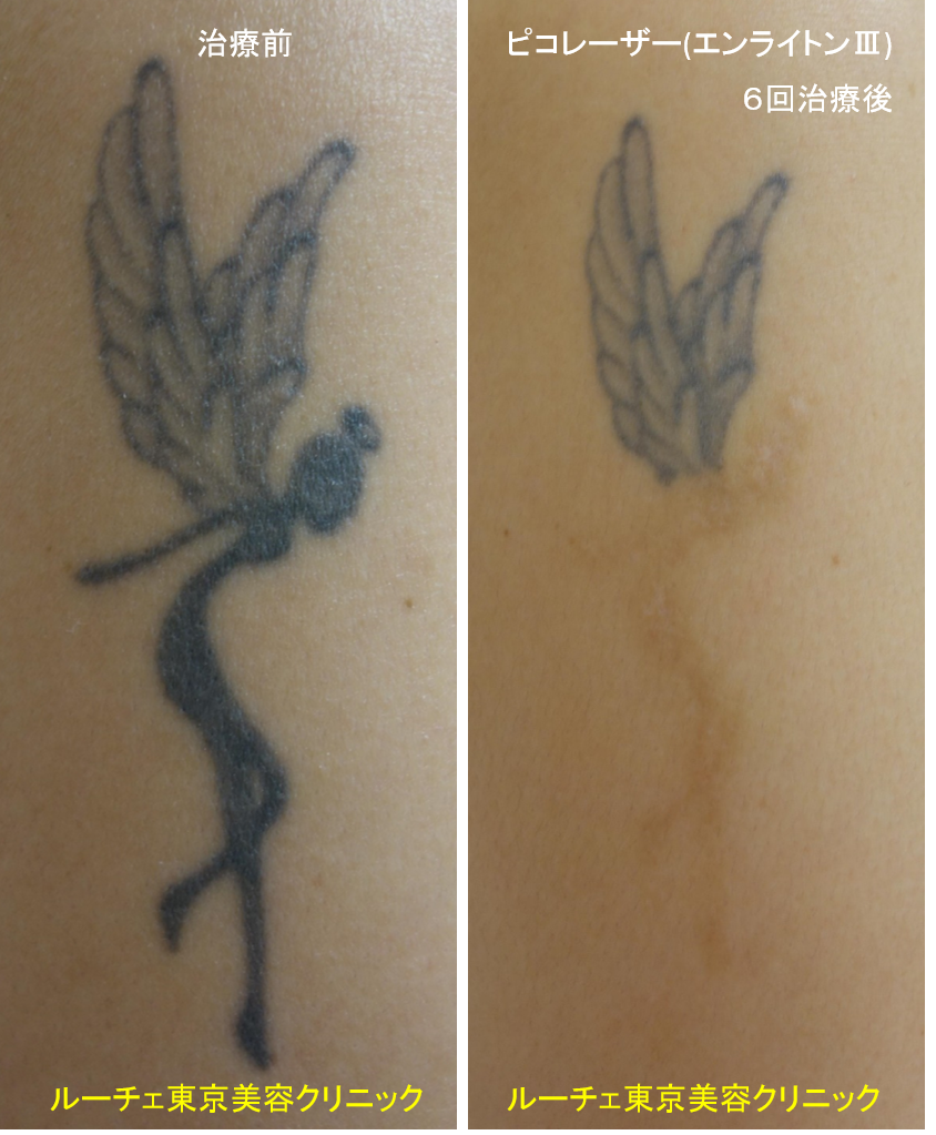 f:id:DrLUCE:20180623131544p:plain f:id:DrLUCE:20180623131544p:plain