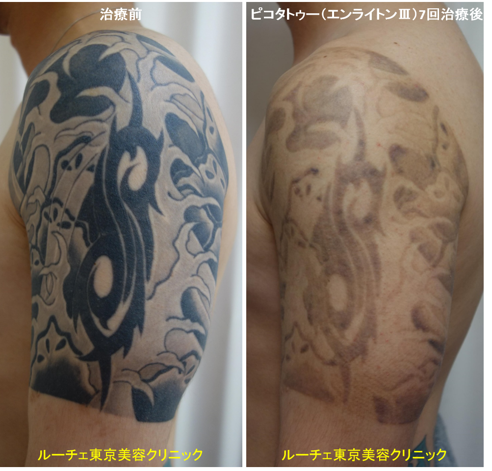 f:id:DrLUCE:20180918154104p:plain f:id:DrLUCE:20180918154104p:plain