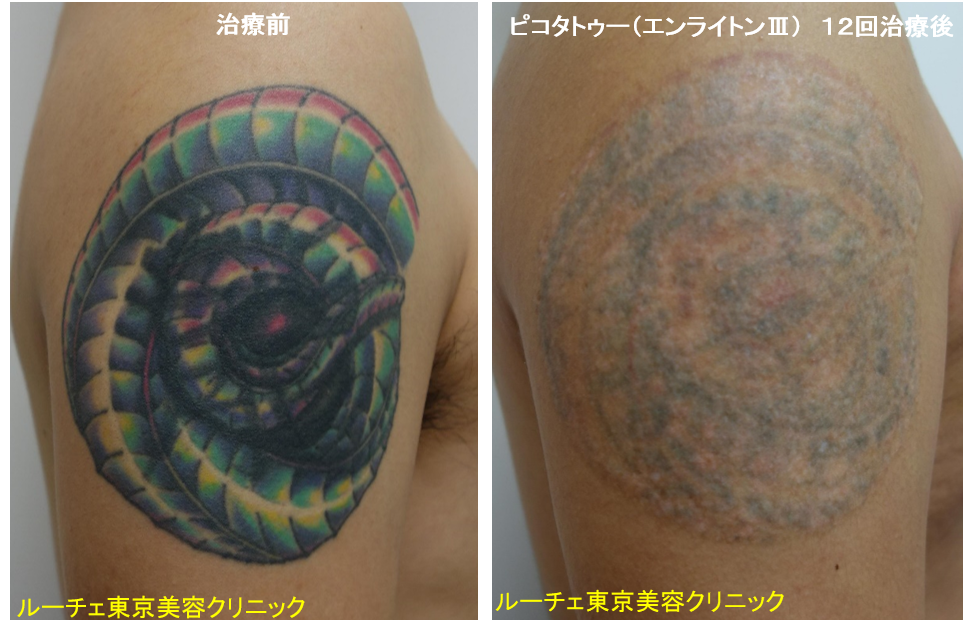 f:id:DrLUCE:20180930145640p:plain