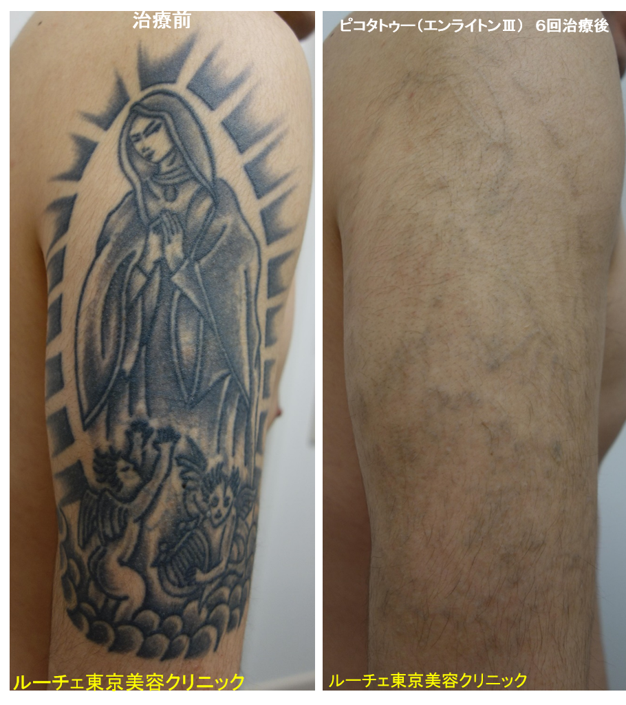 f:id:DrLUCE:20180930154921p:plain