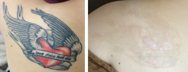 f:id:DrLUCE:20181018194046p:plain f:id:DrLUCE:20181018194046p:plain