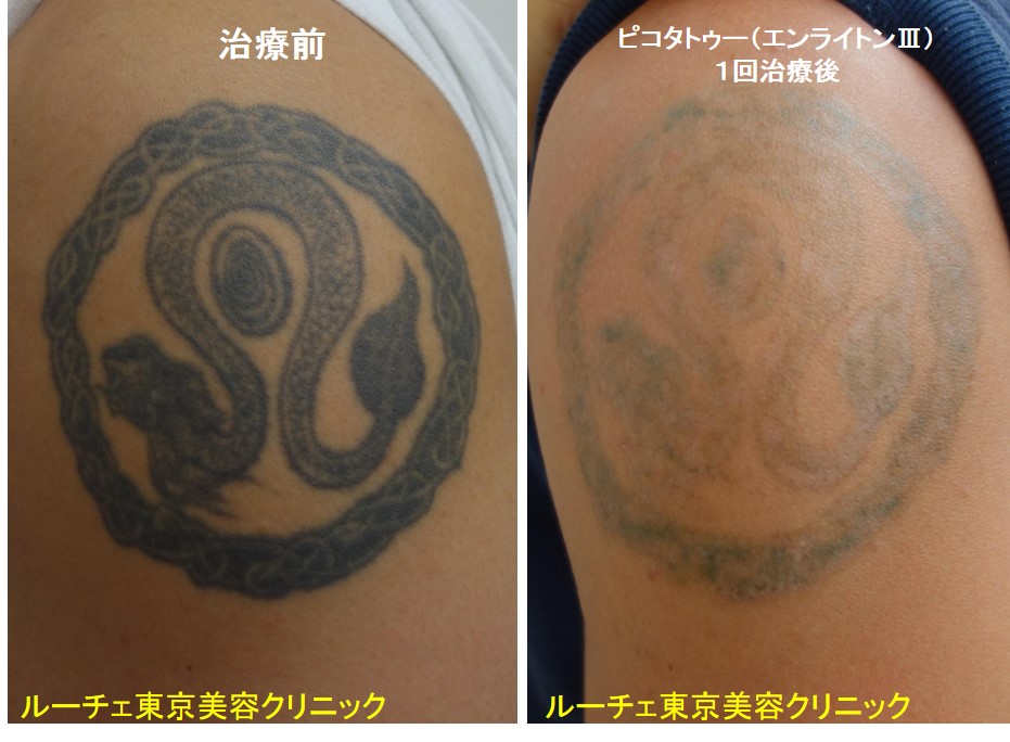 f:id:DrLUCE:20181030134911j:plain f:id:DrLUCE:20181030134911j:plain