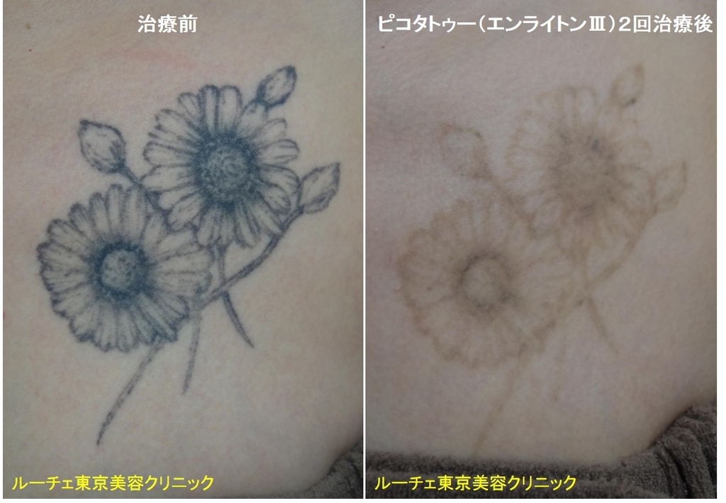 f:id:DrLUCE:20181030154143j:plain