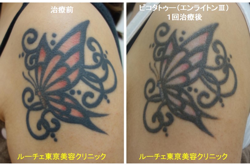 f:id:DrLUCE:20181115124353j:plain