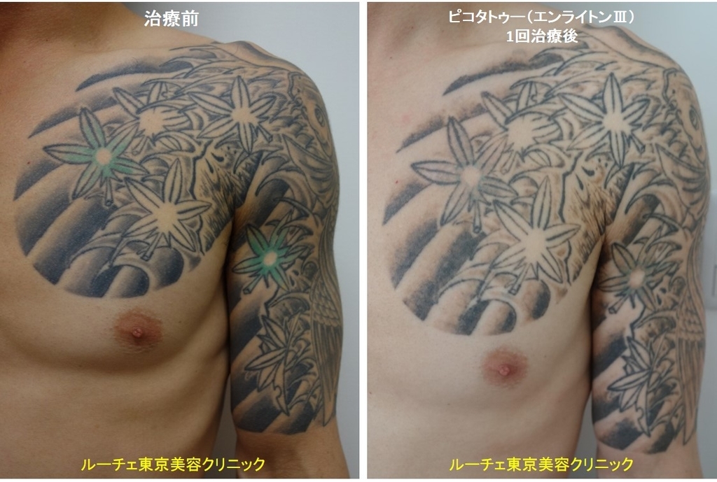 f:id:DrLUCE:20190112112618j:plain