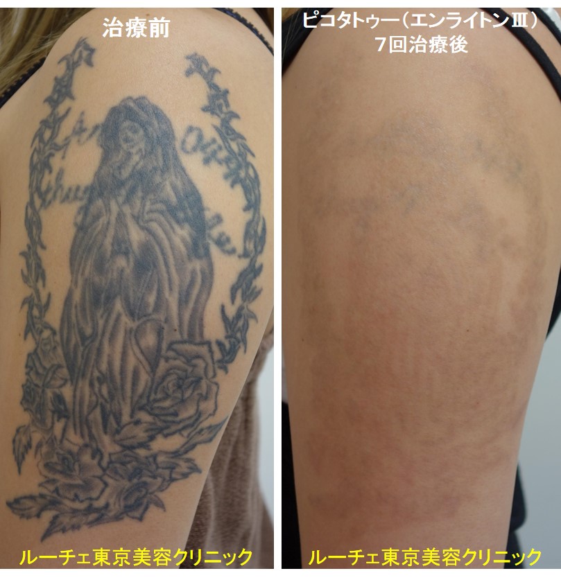 f:id:DrLUCE:20190120174326j:plain f:id:DrLUCE:20190120174326j:plain