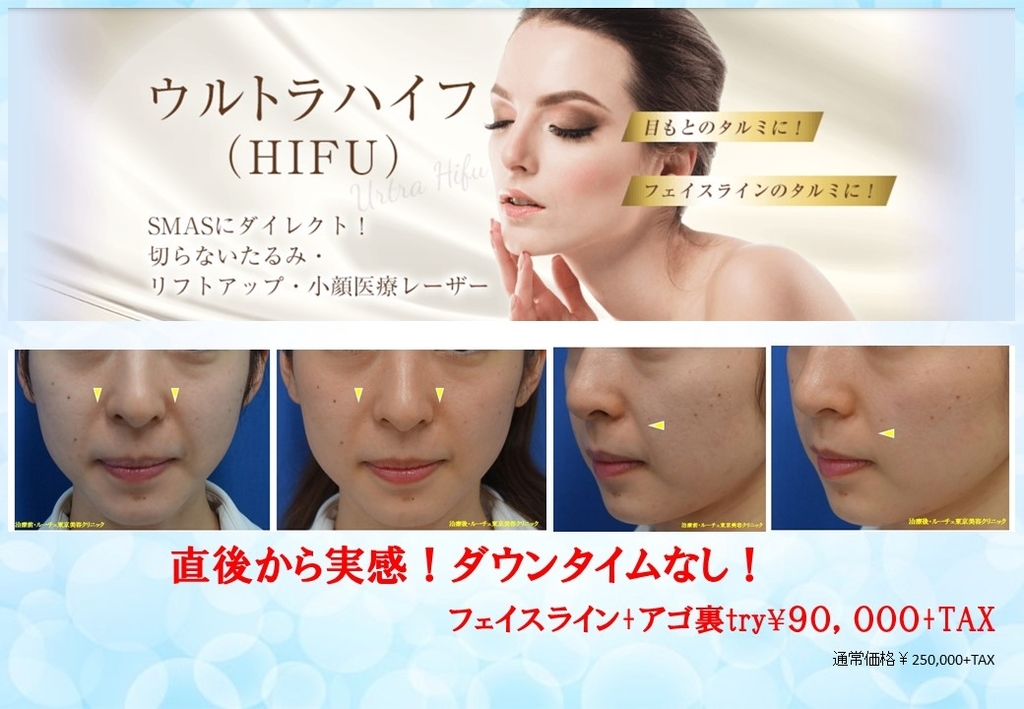 f:id:DrLUCE:20190222152118j:plain