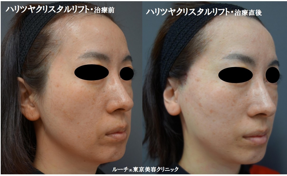 f:id:DrLUCE:20190505170957j:plain