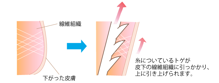 f:id:DrLUCE:20190505171434p:plain