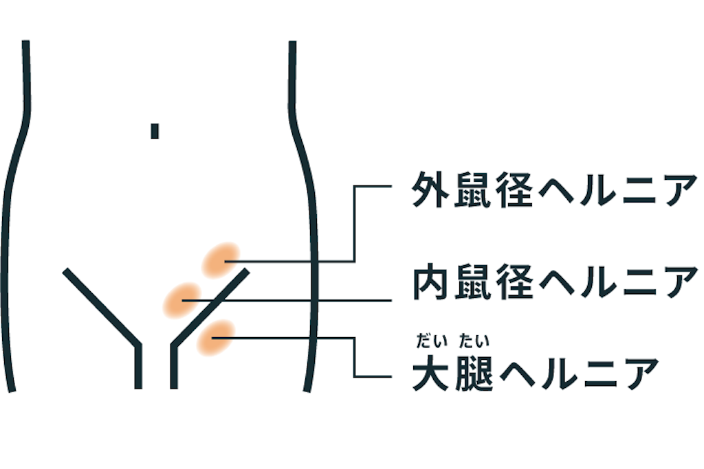 f:id:ED105:20230530055110p:image