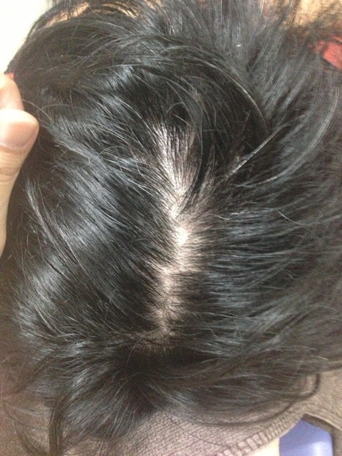 photo:02