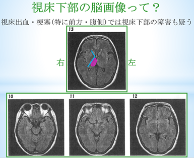 f:id:EPoch:20191115070526p:plain