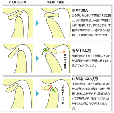 f:id:EPoch:20200814203724p:plain