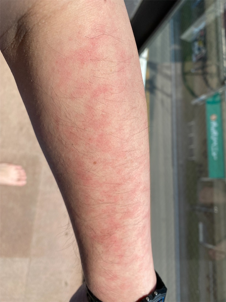 f:id:FJM-sunlight:20220420131806j:image