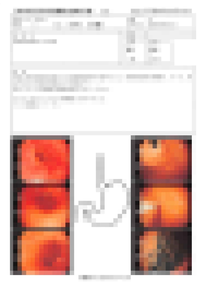 f:id:Frikandel:20180922225350j:plain