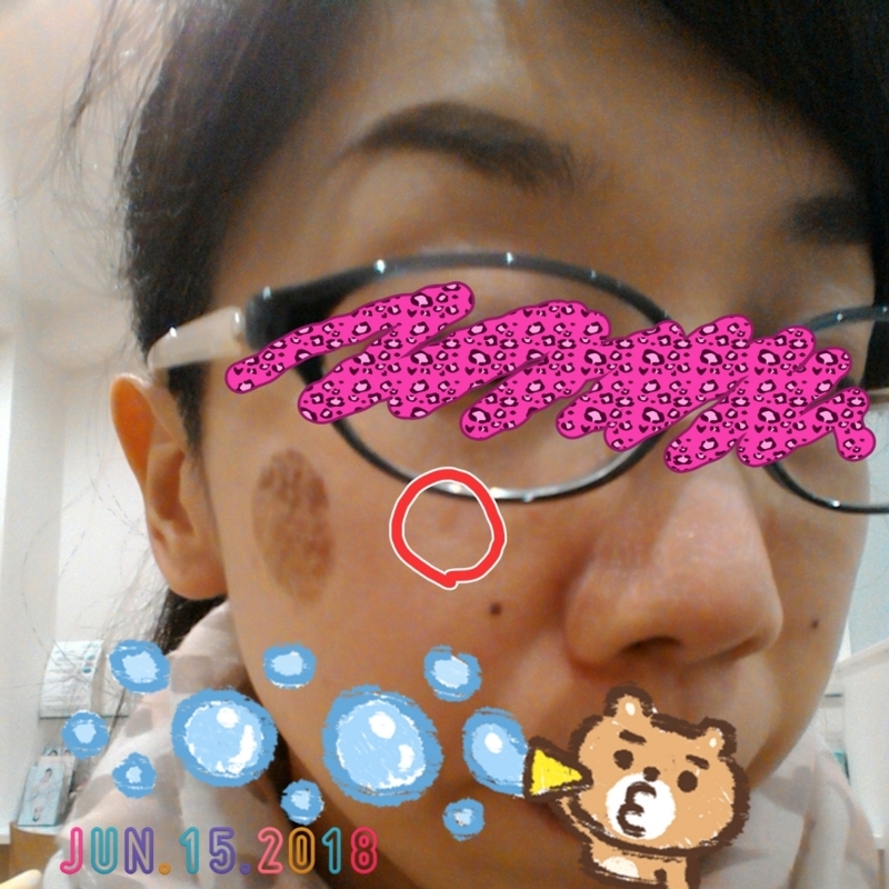 f:id:GOUNN69:20180615185646j:plain