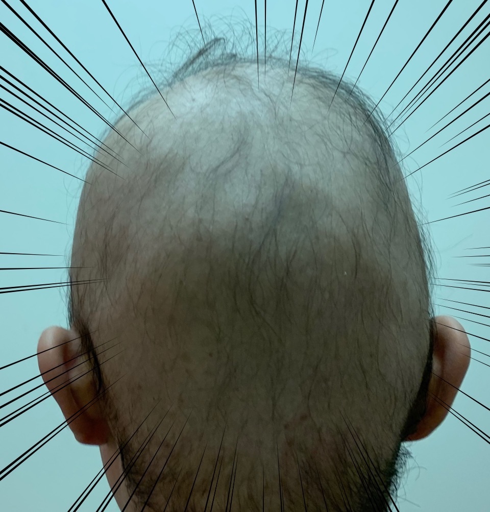 f:id:GUCCHi:20190719030428j:image f:id:GUCCHi:20190719030428j:image