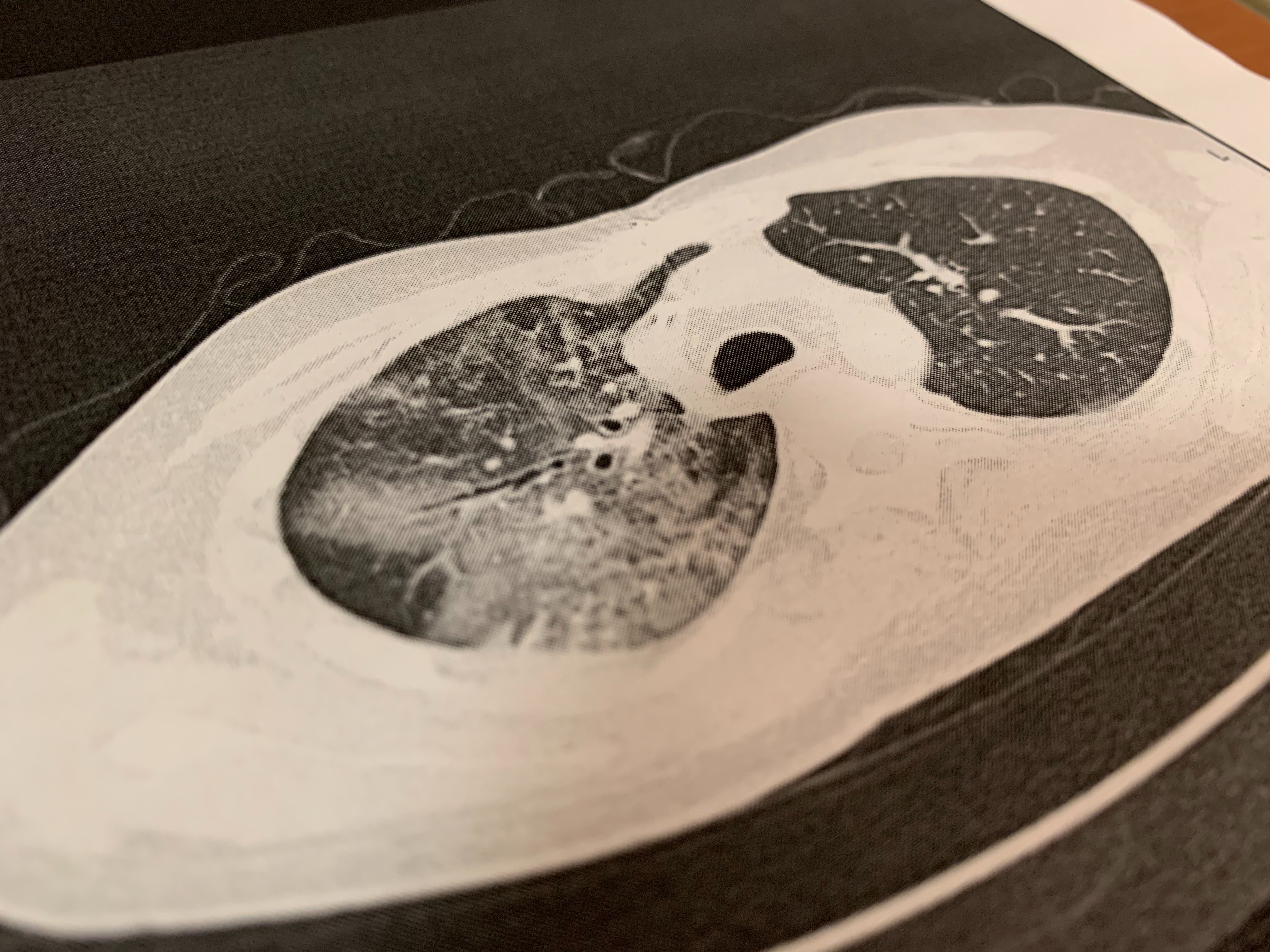 f:id:GUCCHi:20191112173410j:image f:id:GUCCHi:20191112173410j:image