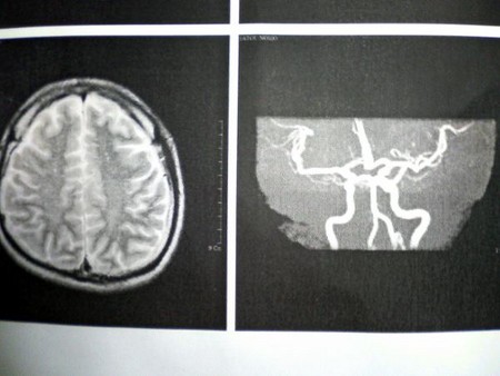 f:id:Gittyom:20070222235912j:image:w150