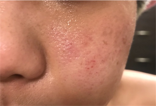 美肌を目指して歩き続ける