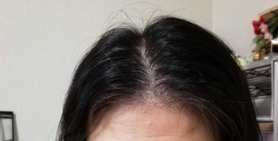 抜け毛が気になる時に試してほしい3つのこと 簡単にできます Nyaoblog