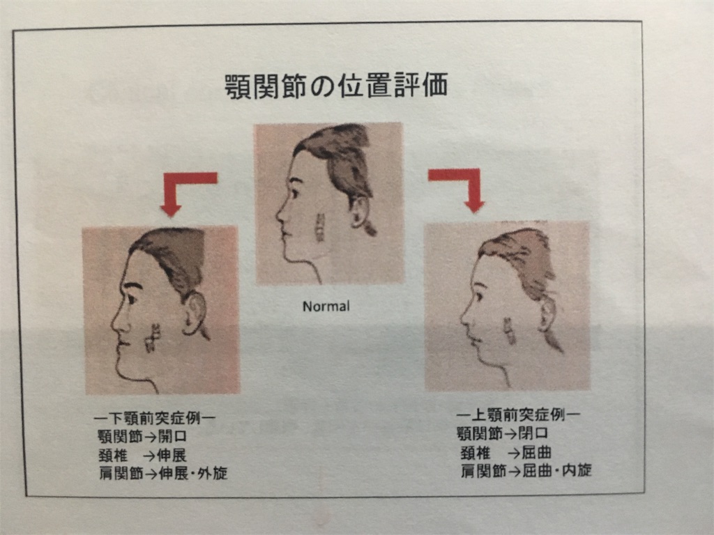 f:id:Harinabis:20190629223424j:image f:id:Harinabis:20190629223424j:image