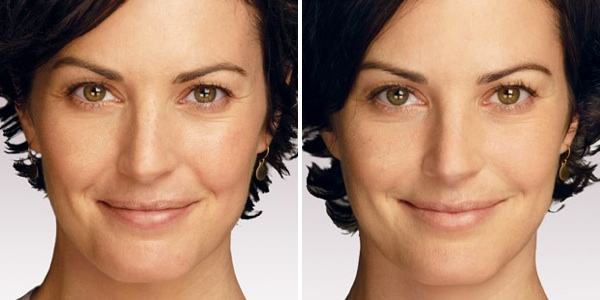 f:id:HealthTalkRev:20200129143153j:plain