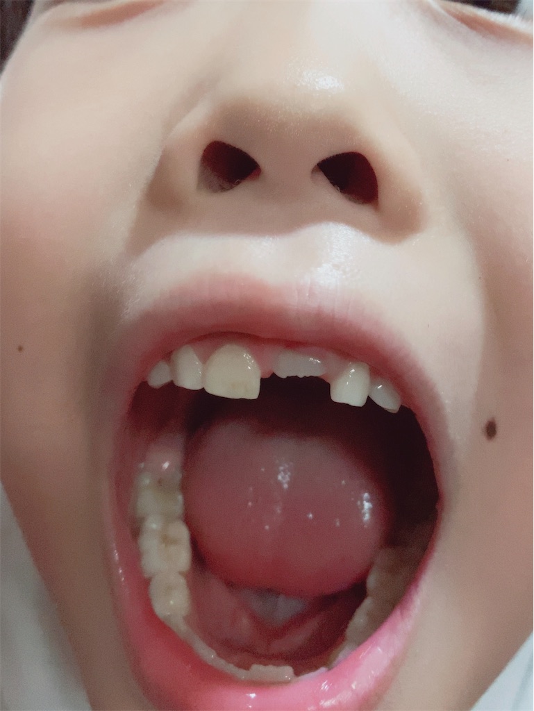 f:id:Himithunonukeana:20200608211400j:image f:id:Himithunonukeana:20200608211400j:image