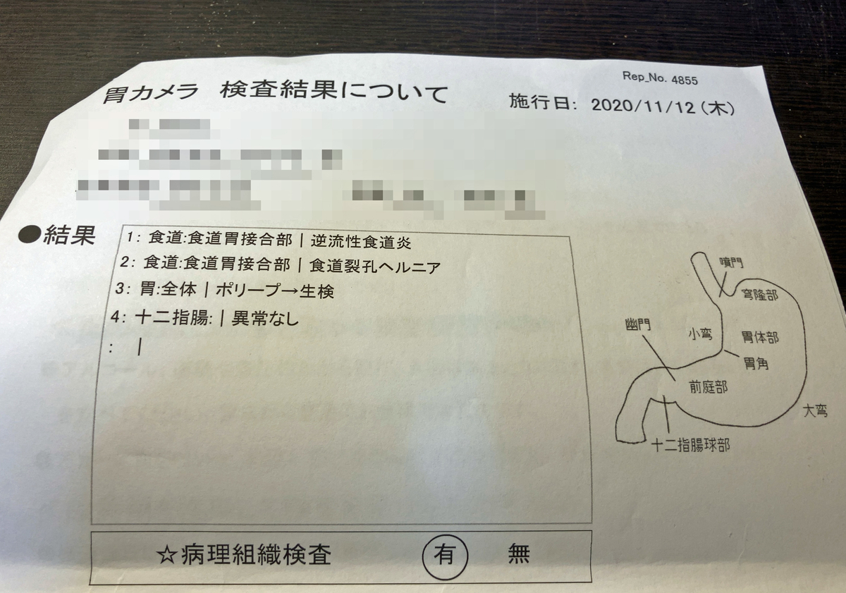 f:id:ICHIZO:20201113020509j:plain