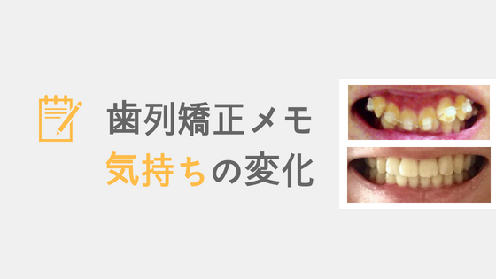 f:id:IMURUTA:20180825144714p:plain 歯列矯正をやる前とやった後の気持ちの変化の体験談